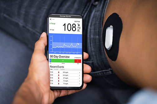 continuous glucose monitoring